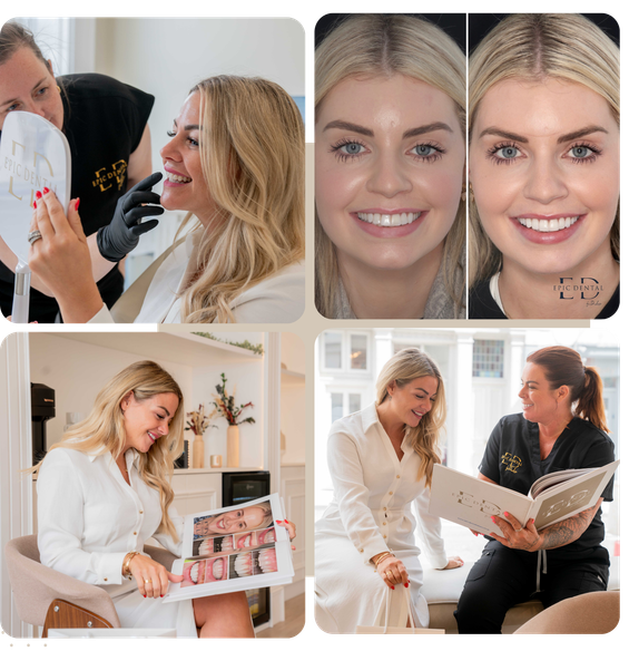 Epic Dental patient collage